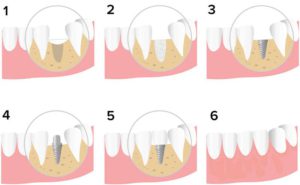 в Краснодарском крае имплантацию зубов практикуют во всех современных стоматологических клиниках